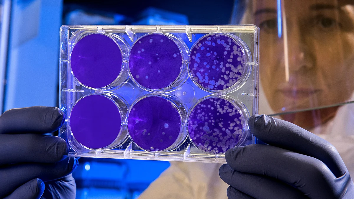 Due to continuing overuse and misuse, the number of bacteria strains that are resistant to multiple antibiotics is increasing, affecting millions of people worldwide.