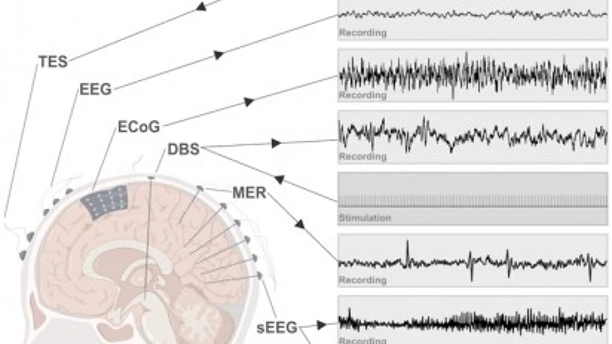 Major electrical recording and stimulation approaches for brain machine interfaces.