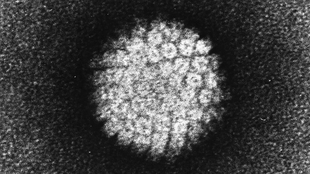 Electron micrograph of a negatively stained human papillomavirus (HPV) which occurs in human warts. Warts on the hands and feet have never been known to progress into cancer. However, after many years cervical warts can become cancerous. Wikimedia Commons