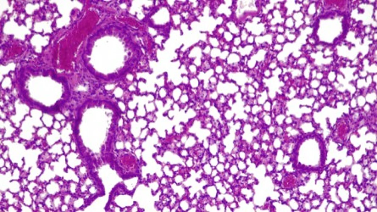 A strain of M. pneumoniae that can manufacture therapeutic compounds i.e. pyocins made to fight P. aeruginosa was used to treat the infected mice. By lessening the consequences of the infection and maintaining air in the alveoli, this medicinal strain of M. pneumoniae functions as a "living drug."