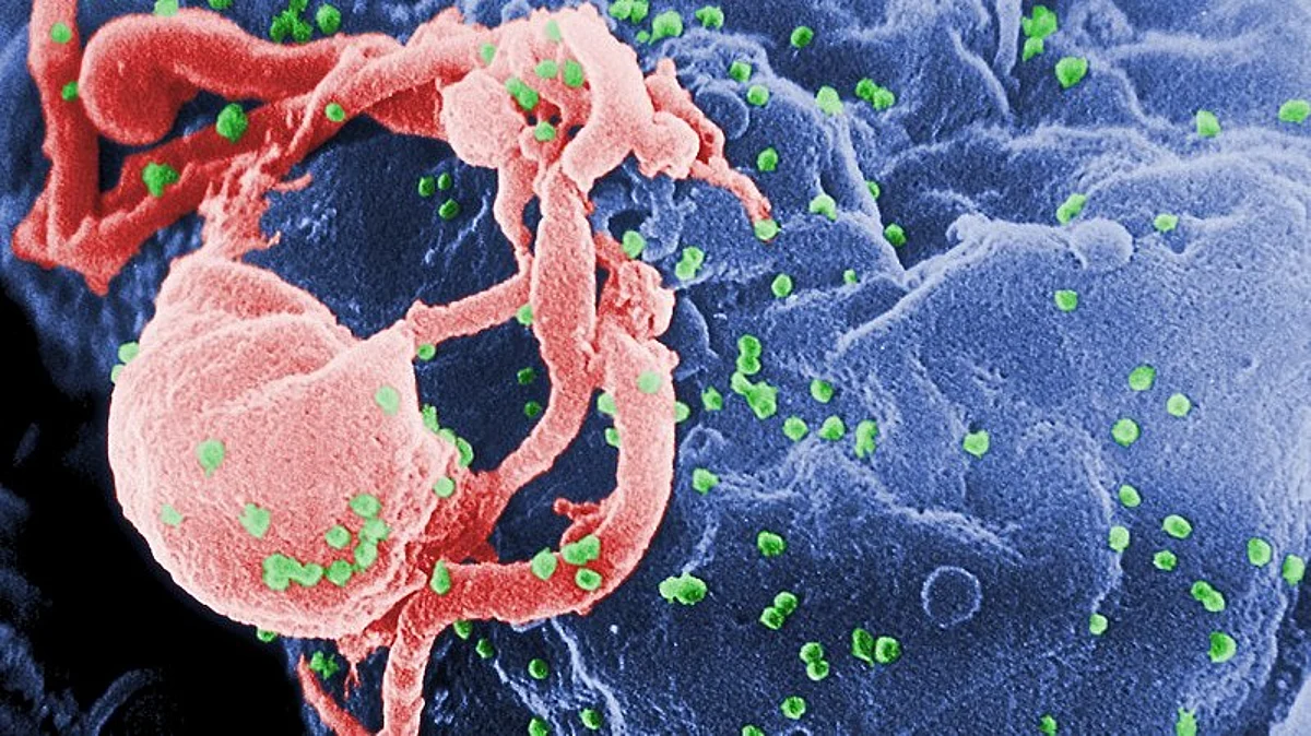 People with HIV have a higher chance of having chronic systemic inflammation during pregnancy. Wikimedia Commons.