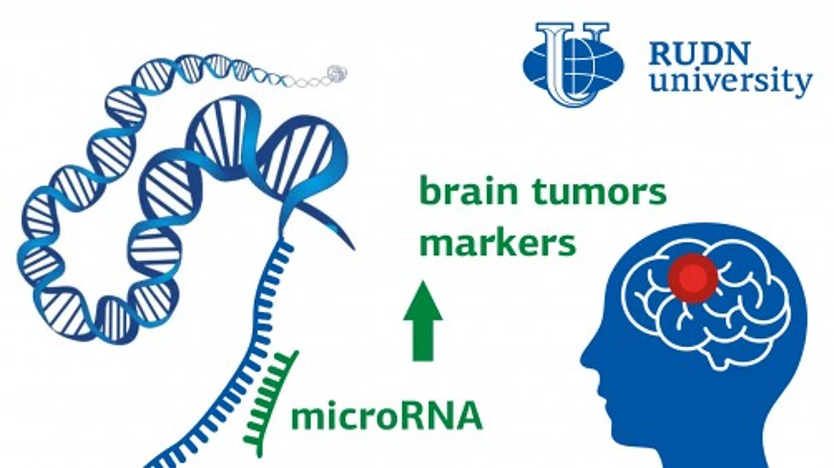 RUDN University neurosurgeons have discovered potential markers of the most common brain tumor. They turned out to be microRNAs - small sequences of nucleotides. So far, there is not enough research in this direction, but in the future, microRNAs will help to diagnose glioma in time
