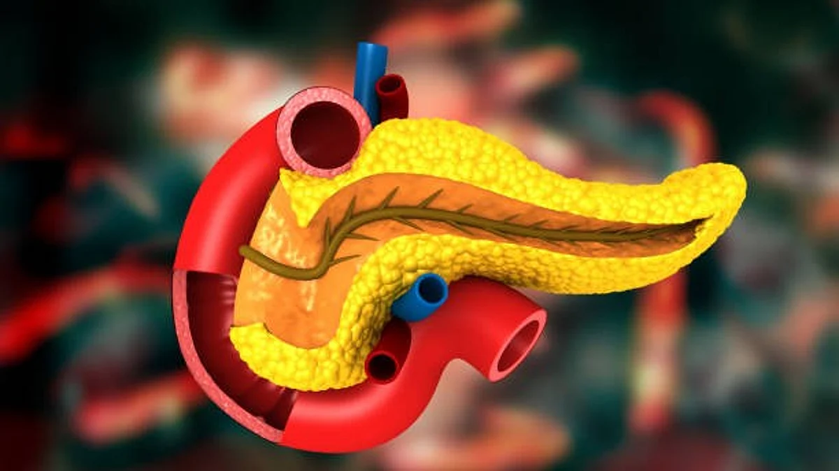 Pancreatic ductal adenocarcinoma (PDAC) is a highly lethal malignancy with a poor prognosis and limited treatment options.