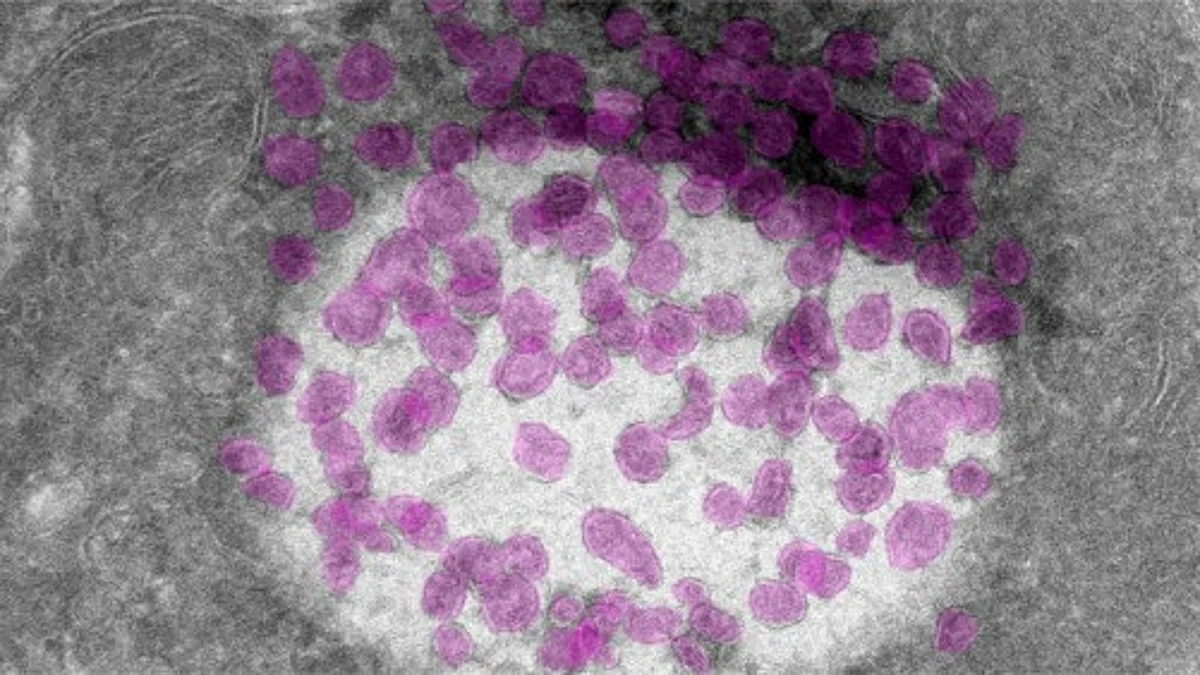 Release of vesicles with transduction proteins in electron microscope magnification