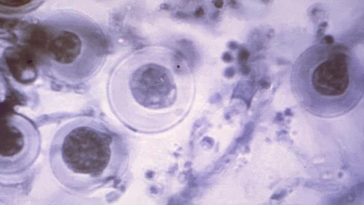 Eukaryotic cells are the ones that make up most life as we know it, including all animals, plants, and fungi. They are highly structured objects (CDC PHIL)