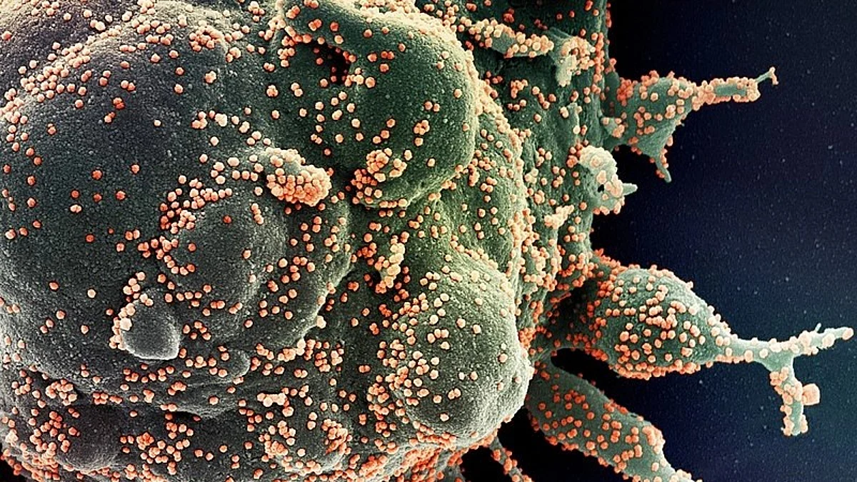 Up to now, only a small amount of research in the context of viral infectious diseases has been carried out on these antibodies, which tend to be considered as an anti-inflammatory, because they are quite rare.
