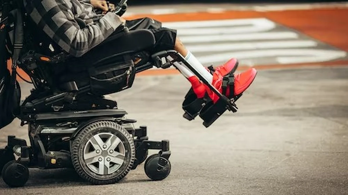Cerebral Palsy is a congenital disorder of movement, muscle tone, or posture. It is due to abnormal brain development, often before birth.