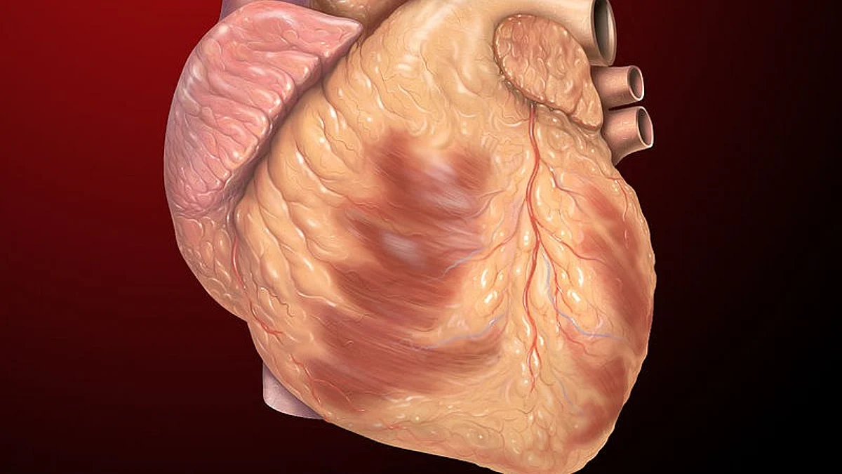 With an aging population and improved healthcare, people are living longer with cardiometabolic diseases are more likely to get two or more of these conditions in a lifetime, known as cardiometabolic multimorbidity