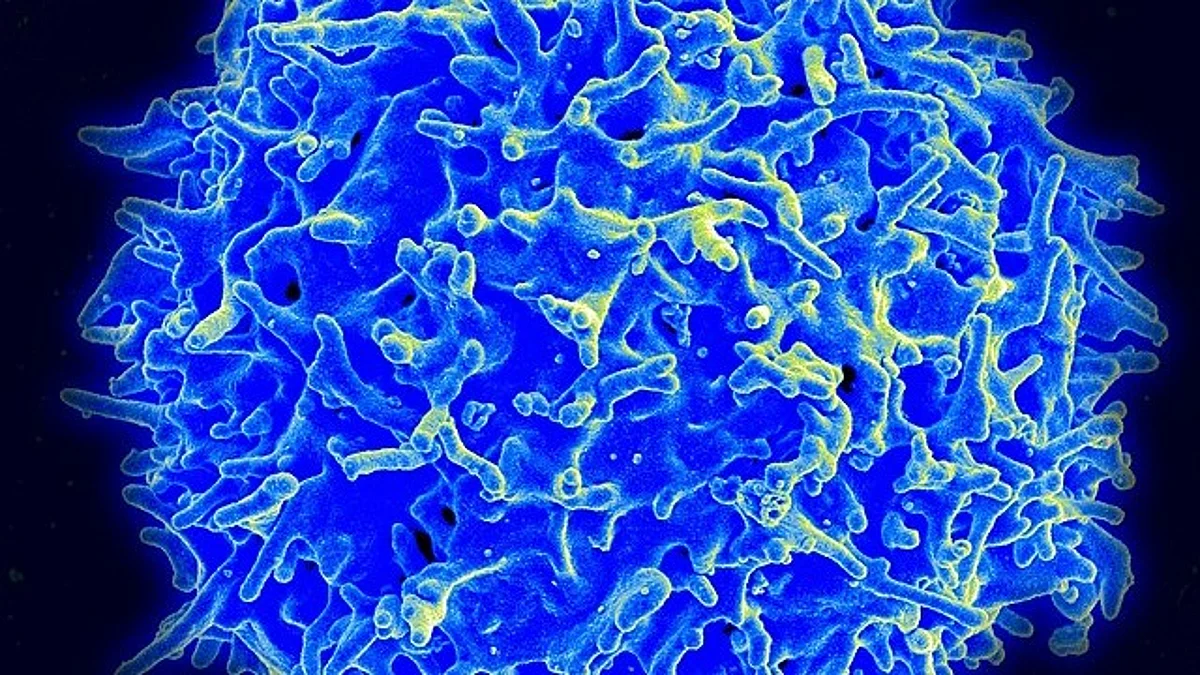 Afami-cel Phase I trial shows noteworthy responses in synovial sarcoma.