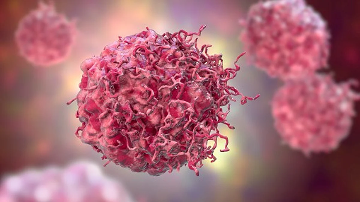 Scientists at Cold Spring Harbor Laboratory (CSHL) have discovered a new drug target for Ewing sarcoma, a rare kind of cancer usually diagnosed in children and young adults.