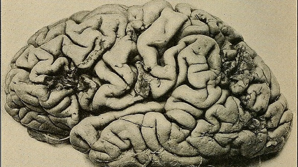 Animal studies have shown that increasing the availability of BDNF encourages the formation and storage of memories, enhances learning and overall boosts cognitive performance.
