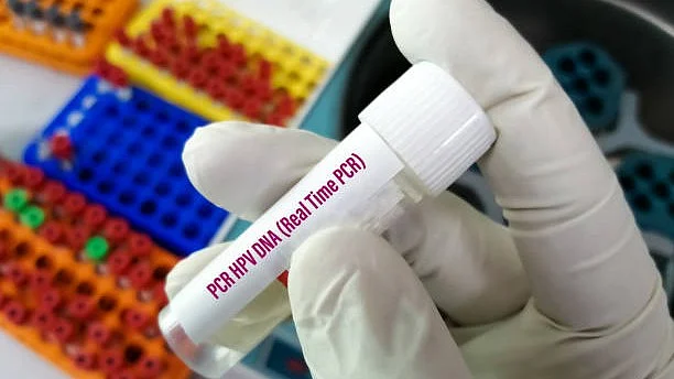 Cervical cancer can be prevented or discovered at an early stage by adequate screening. However, current guidelines, against screening for women 65 years of age and older who have a history of negative Pap and/or Human Papillomavirus (HPV) testing potentially leaving this age group susceptible