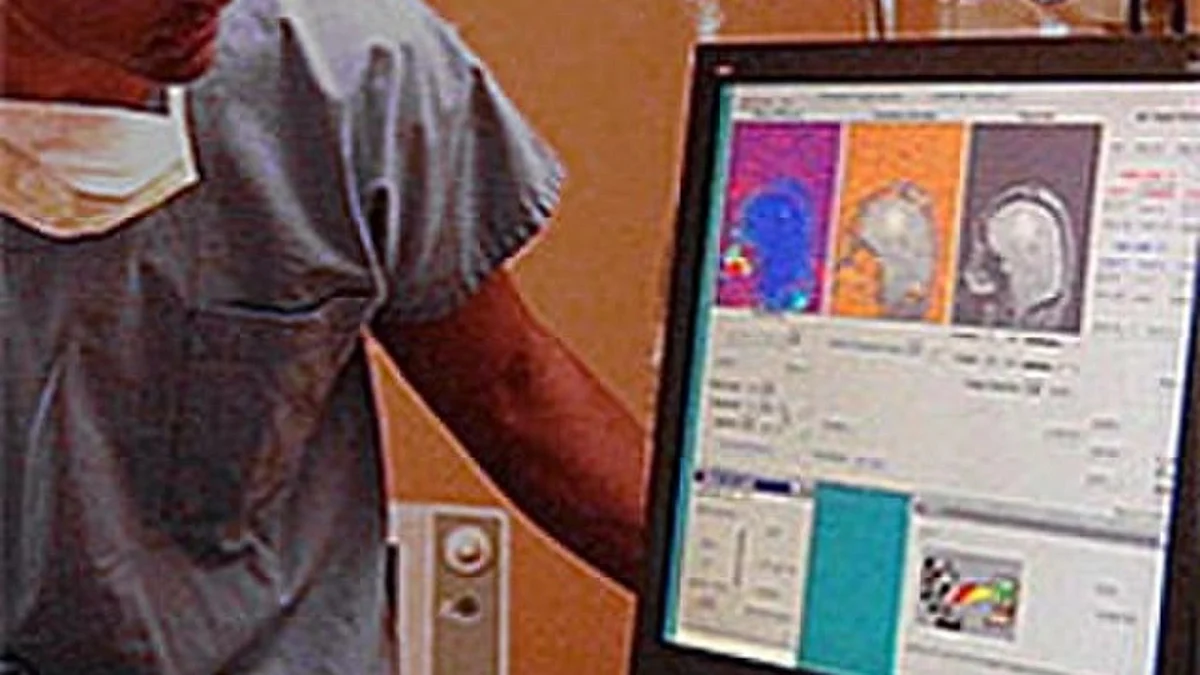 Researchers at the University of Waterloo have created a computational model to predict the growth of deadly brain tumors more accurately. (Representational image: WIKIMEDIA COMMONS)