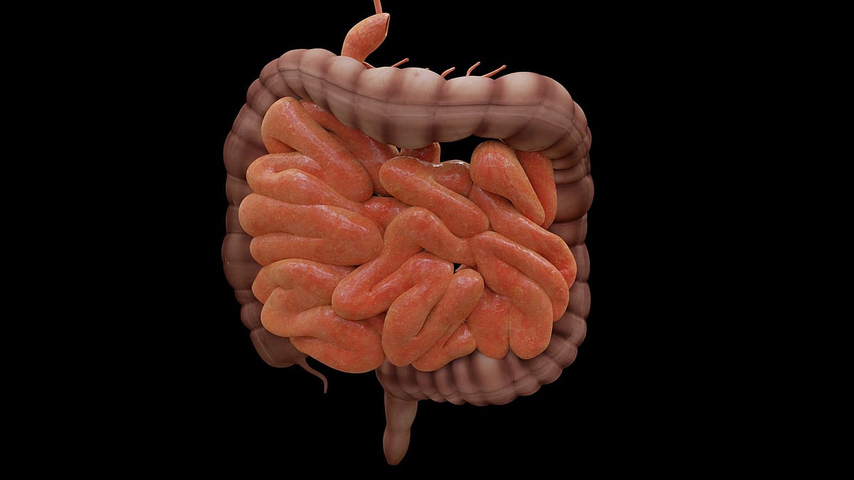 Inverted Intesitines Boy With Twisted Intestines Gets New Lease Of Life After Surgery