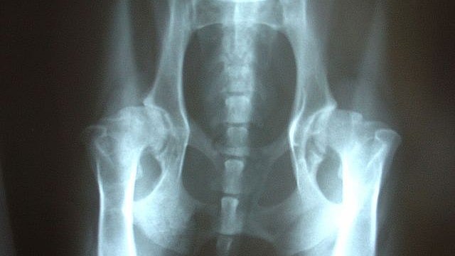 Hip Dysplasia in Young Athletes Evaluation Assessment and Clinical