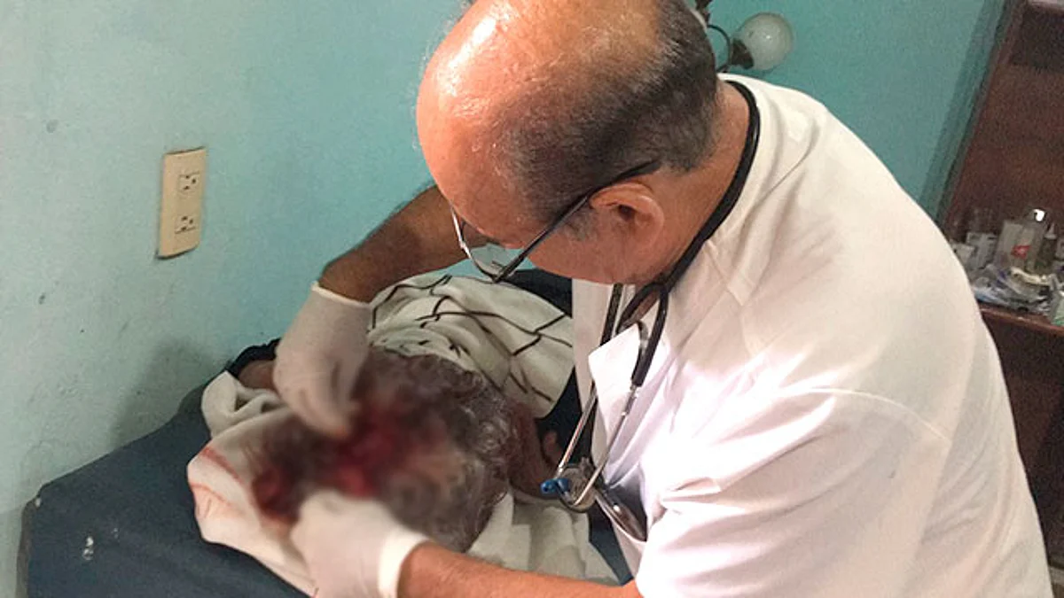 En Uruapan, Pit Bull atacó a una mujer y a su nieto, FGE investiga los hechos