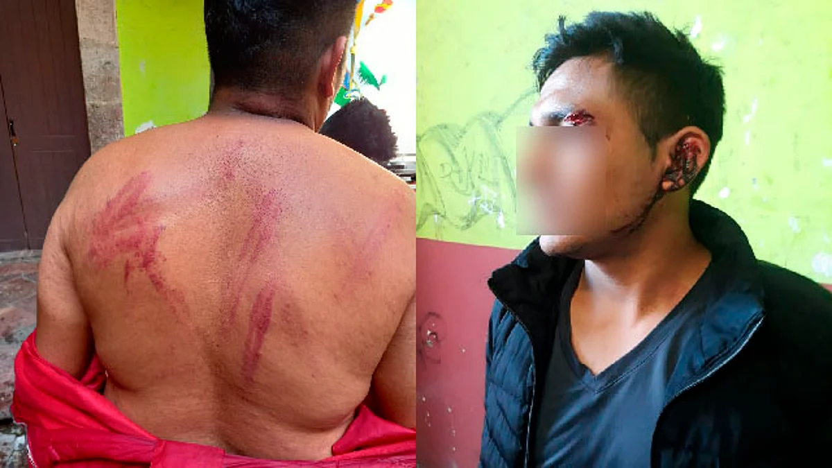 FNLS toma por asalto Casa del Estudiante Isaac Arriaga; hay 6 lesionados