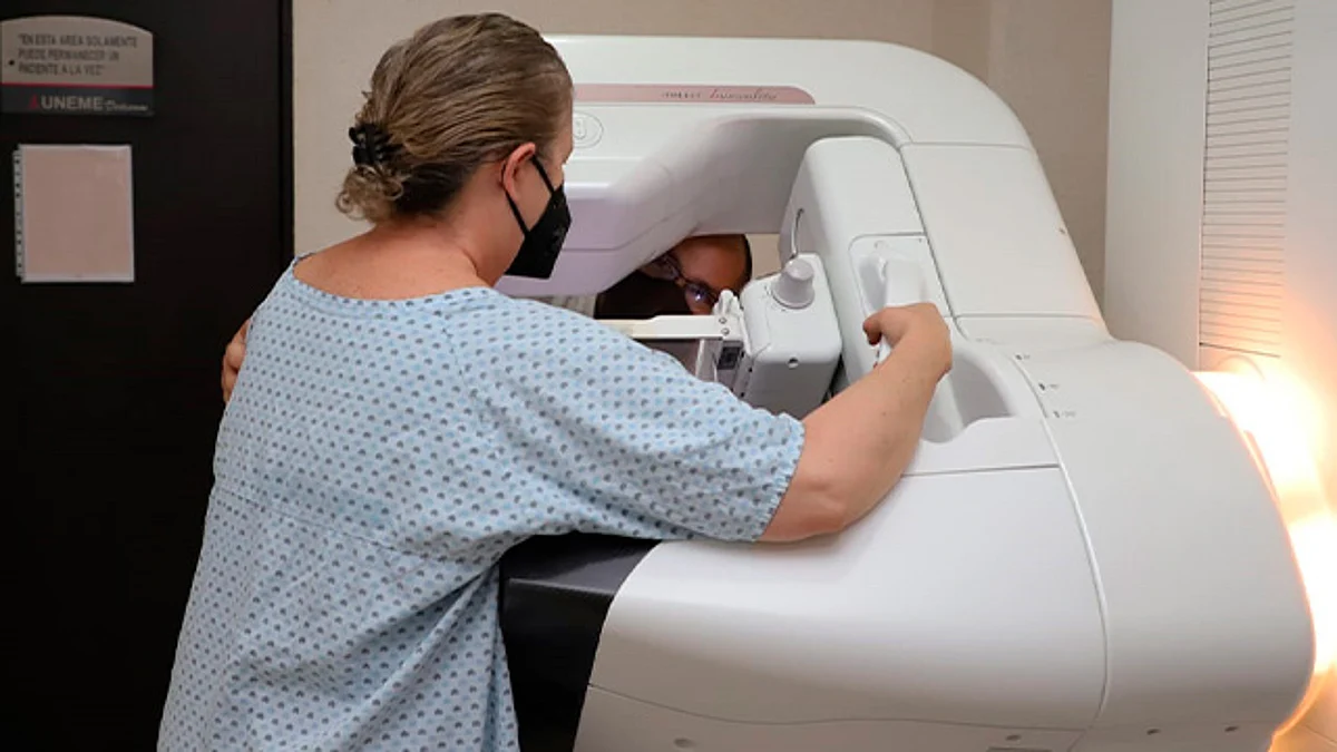 Realizadas, más de 25 mil mastografías por SSM para detectar cáncer de mama