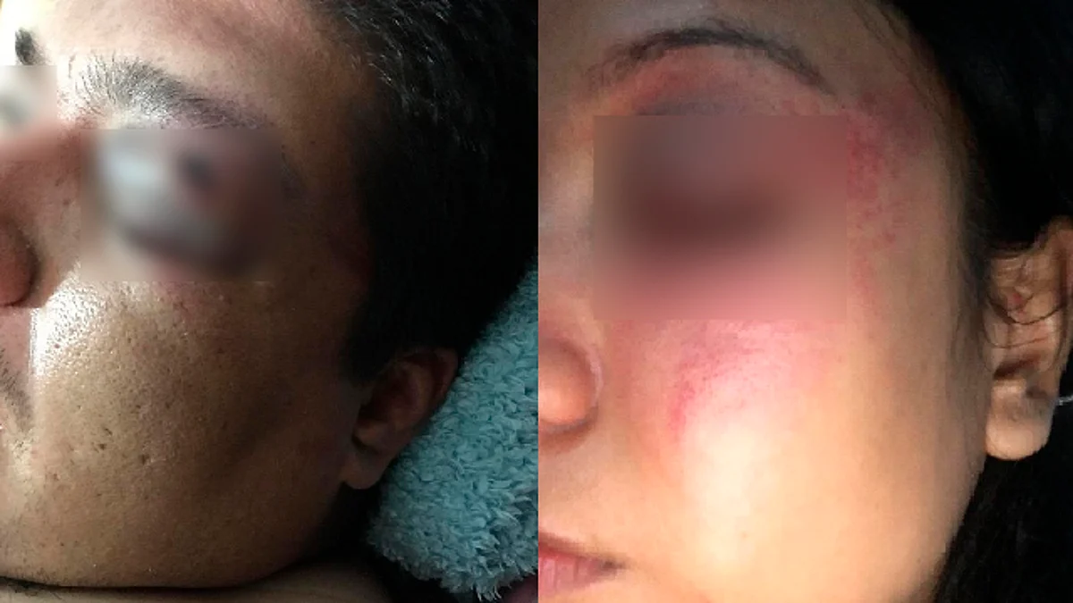 Golpean y asaltan a familia en pleno Centro Histórico de Morelia