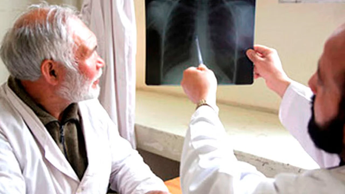 Con motivo del Día Mundial de la Tuberculosis se realizó una sesión en vivo con la participación de tres especialistas del Seguro Social
