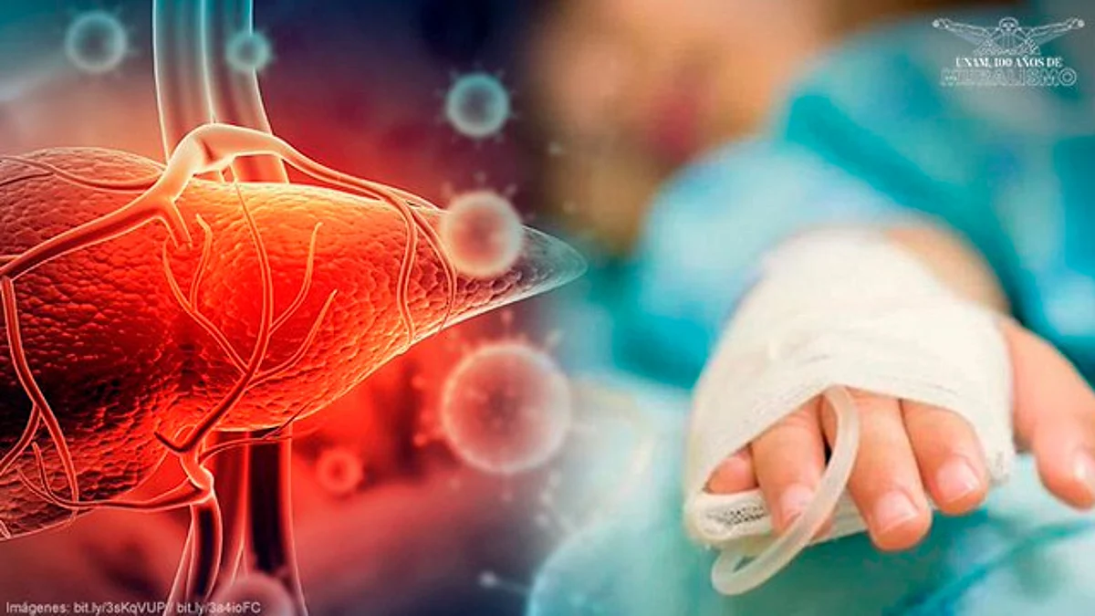 Dolor abdominal, diarrea y vómito preceden casos de hepatitis aguda grave en niños