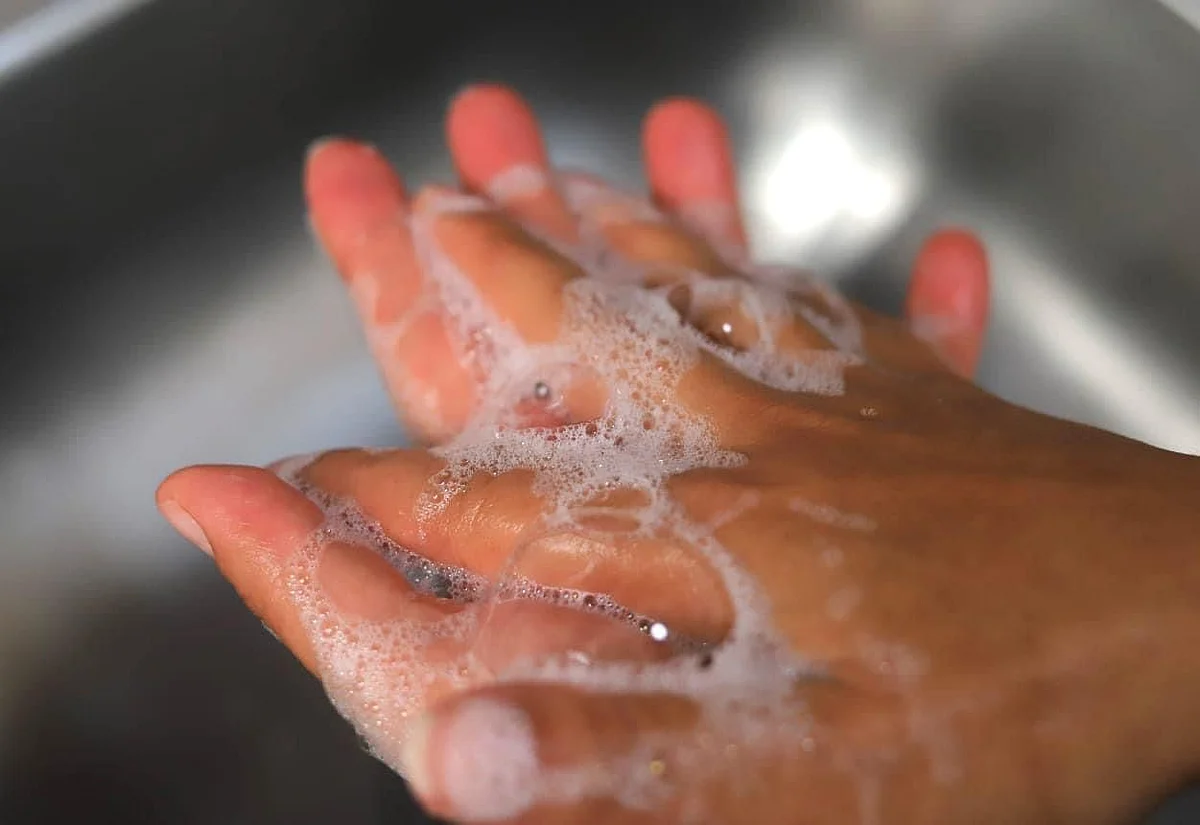 La viruela símica no se propaga por aire, agua o alimentos