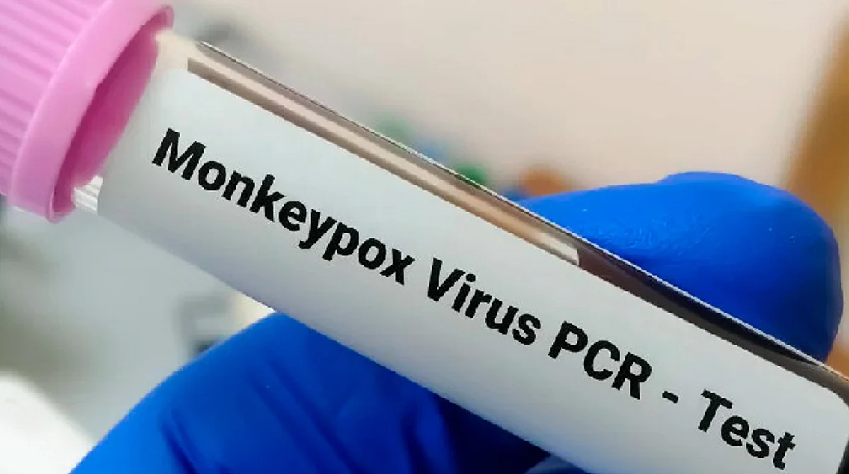 OPS informa: Hay 35 casos de viruela del mono en México