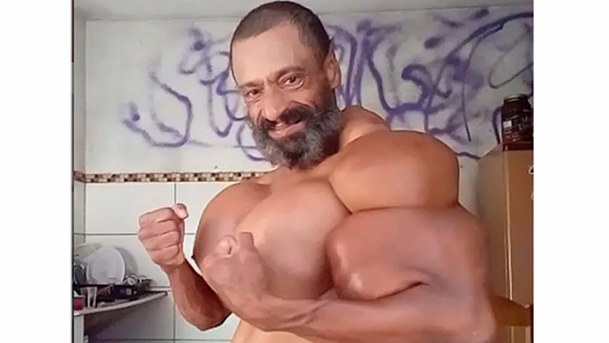 Tuvo un paro cardiaco