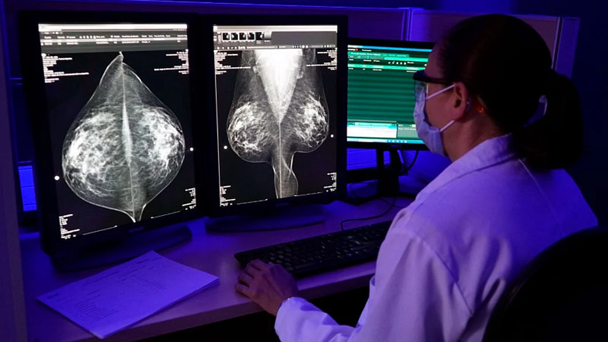 En 2022 realizaron más de 20 mil mastografías: Secretaría de Salud
Michoacán