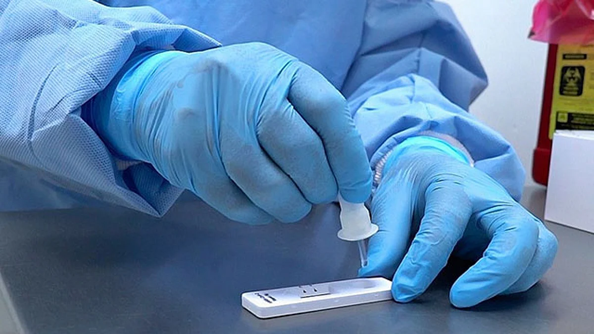 Toda la información es confidencial, después de la toma, personal de salud informará al paciente sobre la fecha en la que estará el resultado