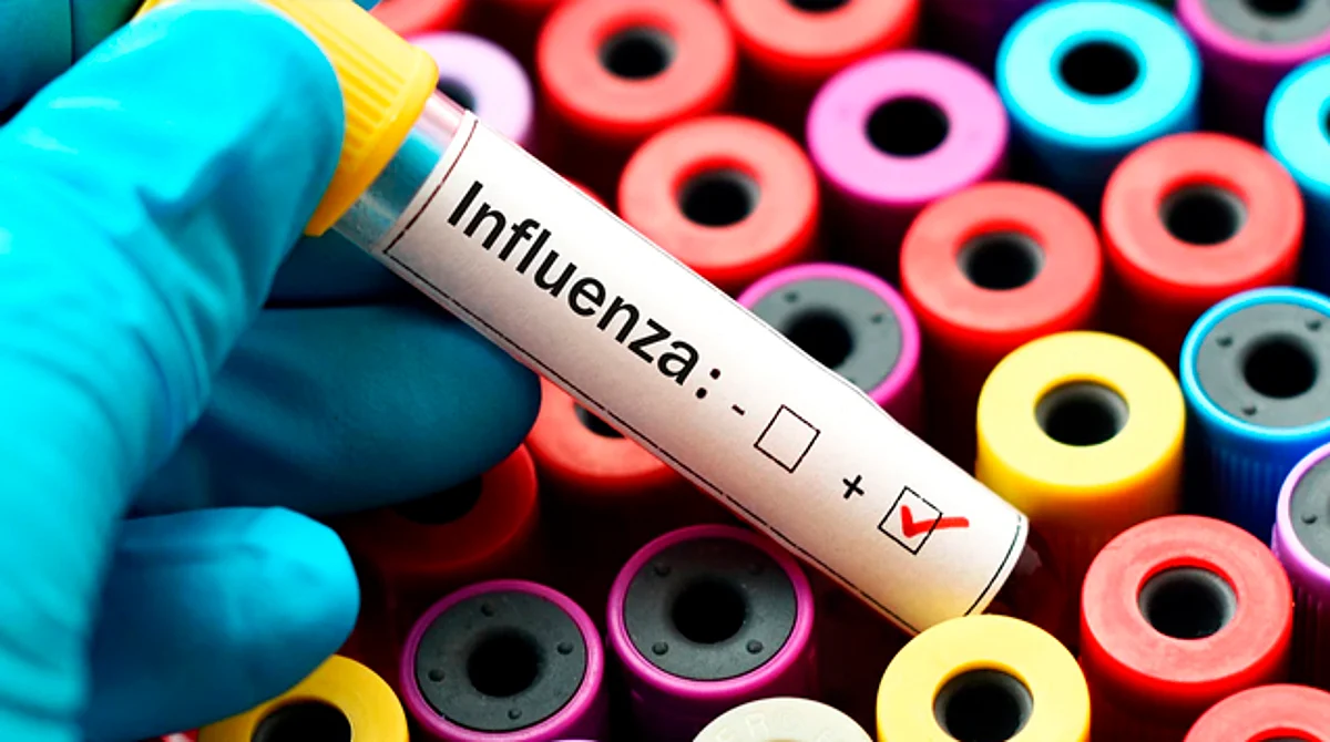 Atípico, incremento de casos de influenza en Michoacán: SSM