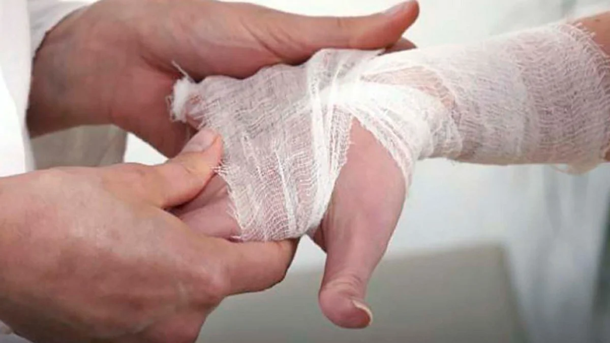 En México disminuyen 97% casos de lepra