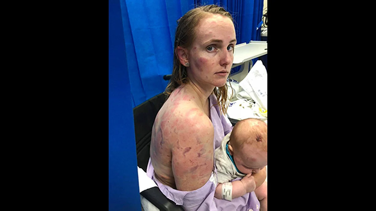 Salvo por unos cuantos chichones a causa de los hielos, la bebé, de sólo 4 meses, resultó ilesa (Foto: Facebook Fiona Simpson)