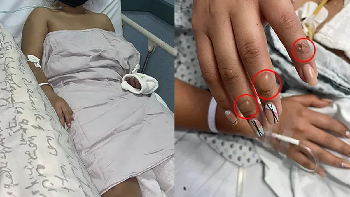Madre pide justicia por su hija; fue ATACADA con ÁCIDO, en Michoacán