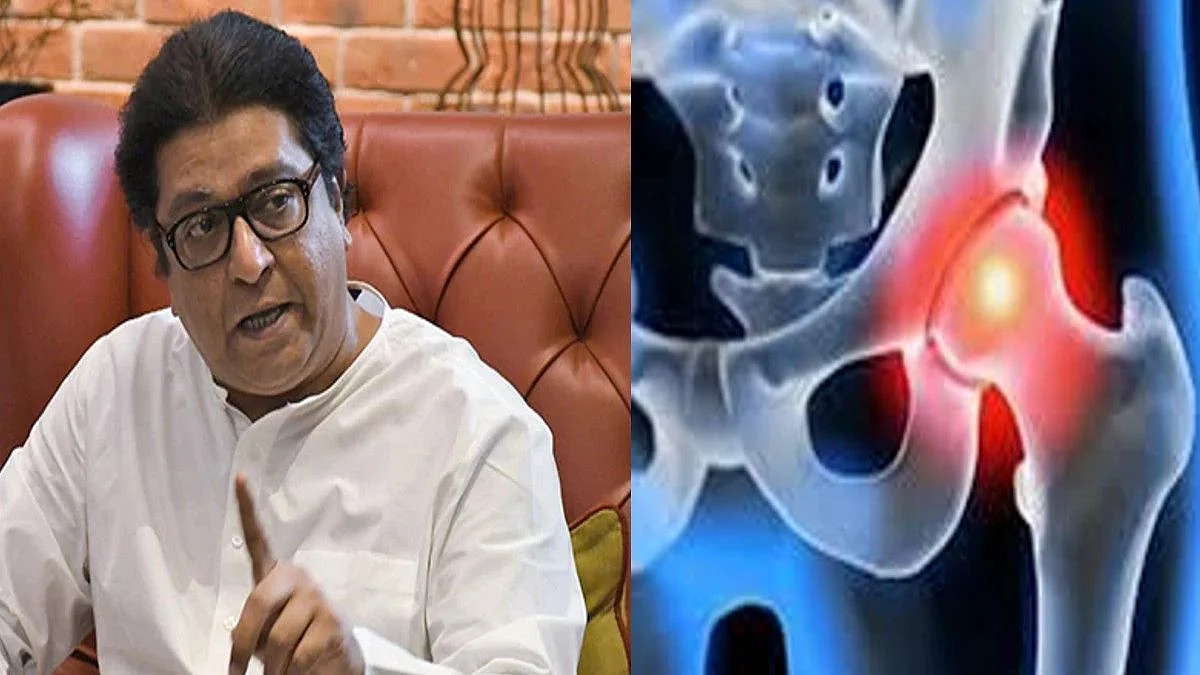 राज ठाकरेंवर होणार Hip Bone ची शस्त्रक्रिया, जाणून घ्या नेमका हा आजार काय? लक्षणं काय?