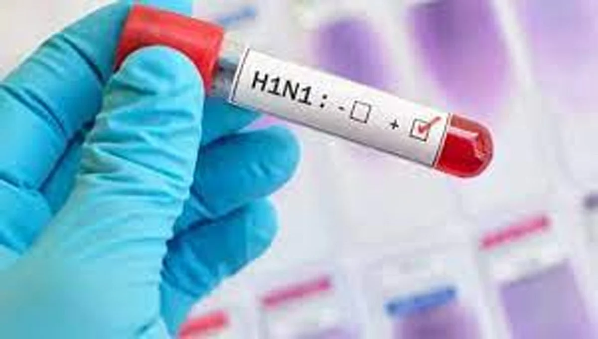 2 women die due to swine flu in Nagpur, total 62 deaths in the city so far