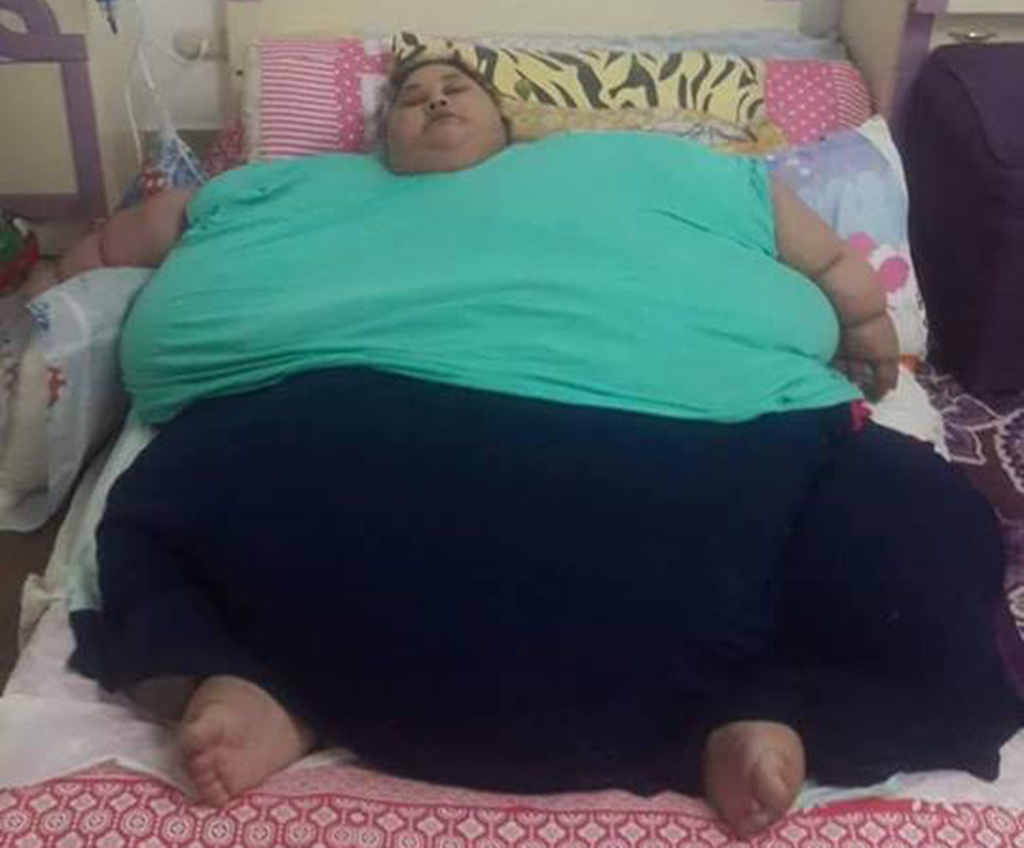 Weight loss surgery goes awry for Mumbai hospital
