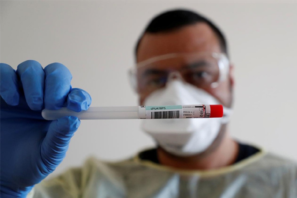 SGPGIMS develops cheaper, faster test for COVID-19