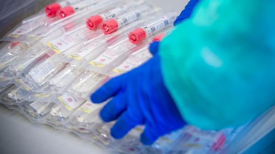 Coronavirus LIVE Updates: 440 more COVID-19 cases & 10 deaths reported in West Bengal