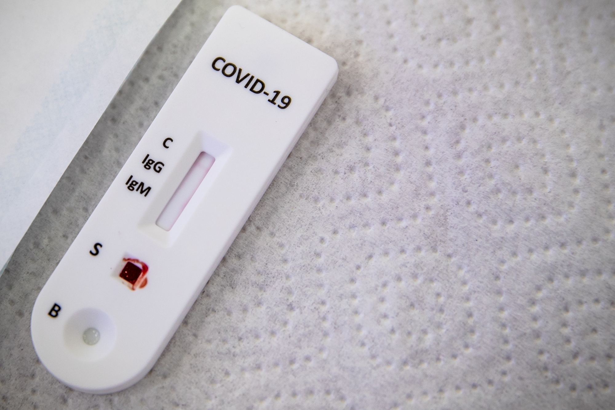 2 Delhi patients found reinfected with COVID-19 within month of recovery, says Ganga Ram Hospital