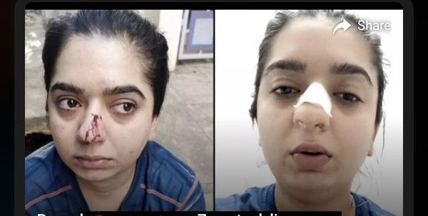 Zomato delivery executive mugged me, says Bengaluru model