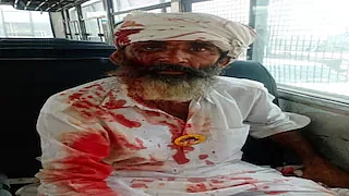 A farmer injured in the police lathicharge