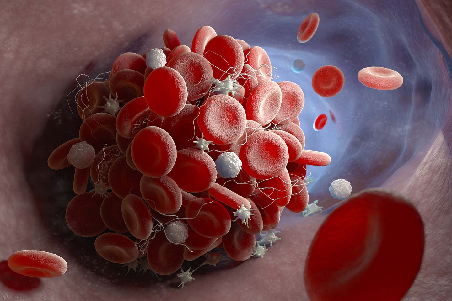 Blood clot risk much higher from COVID-19 than after vaccination: Oxford-led study