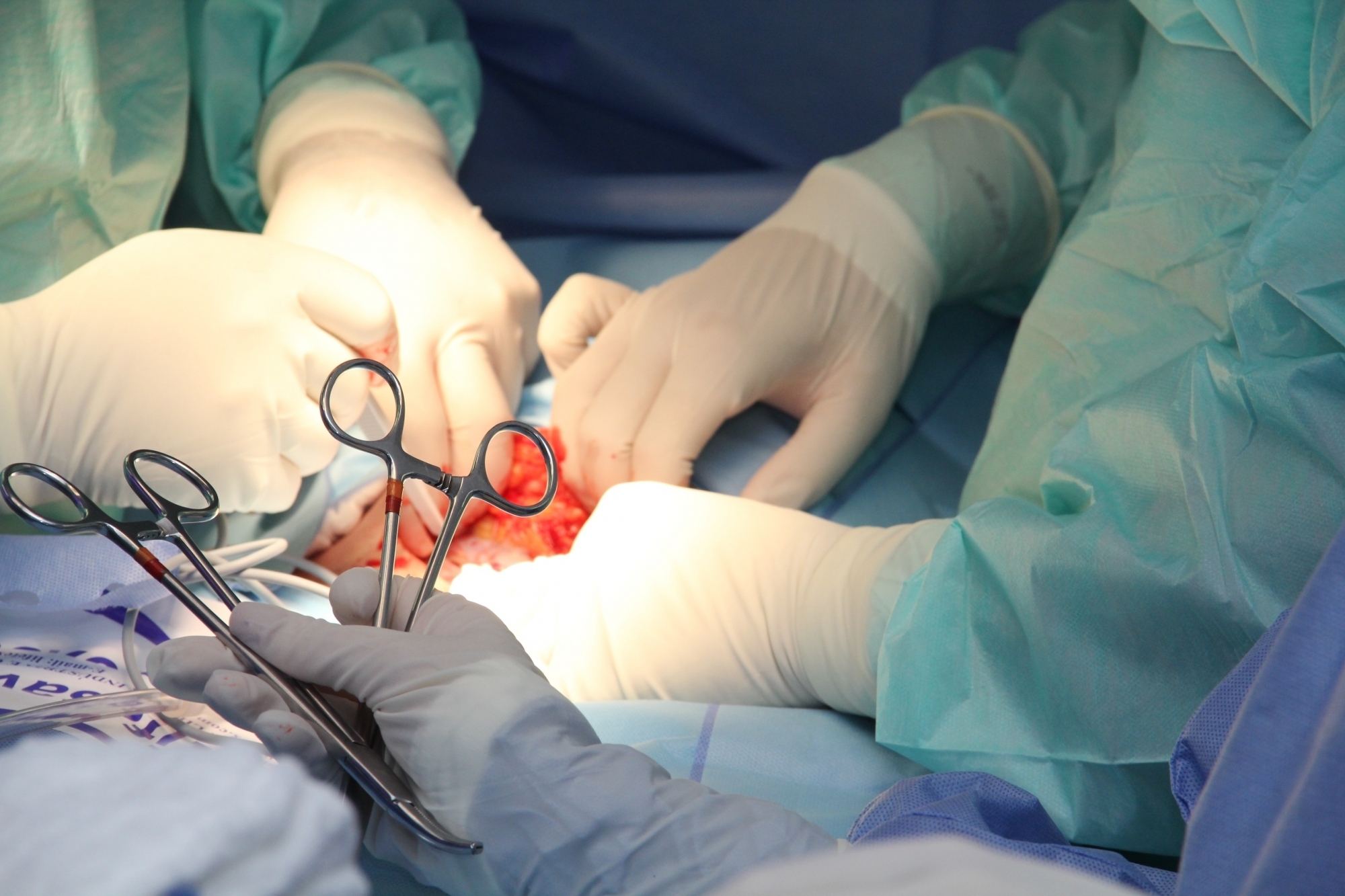 PGI doctors perform endoscopic removal of tumour through nose
