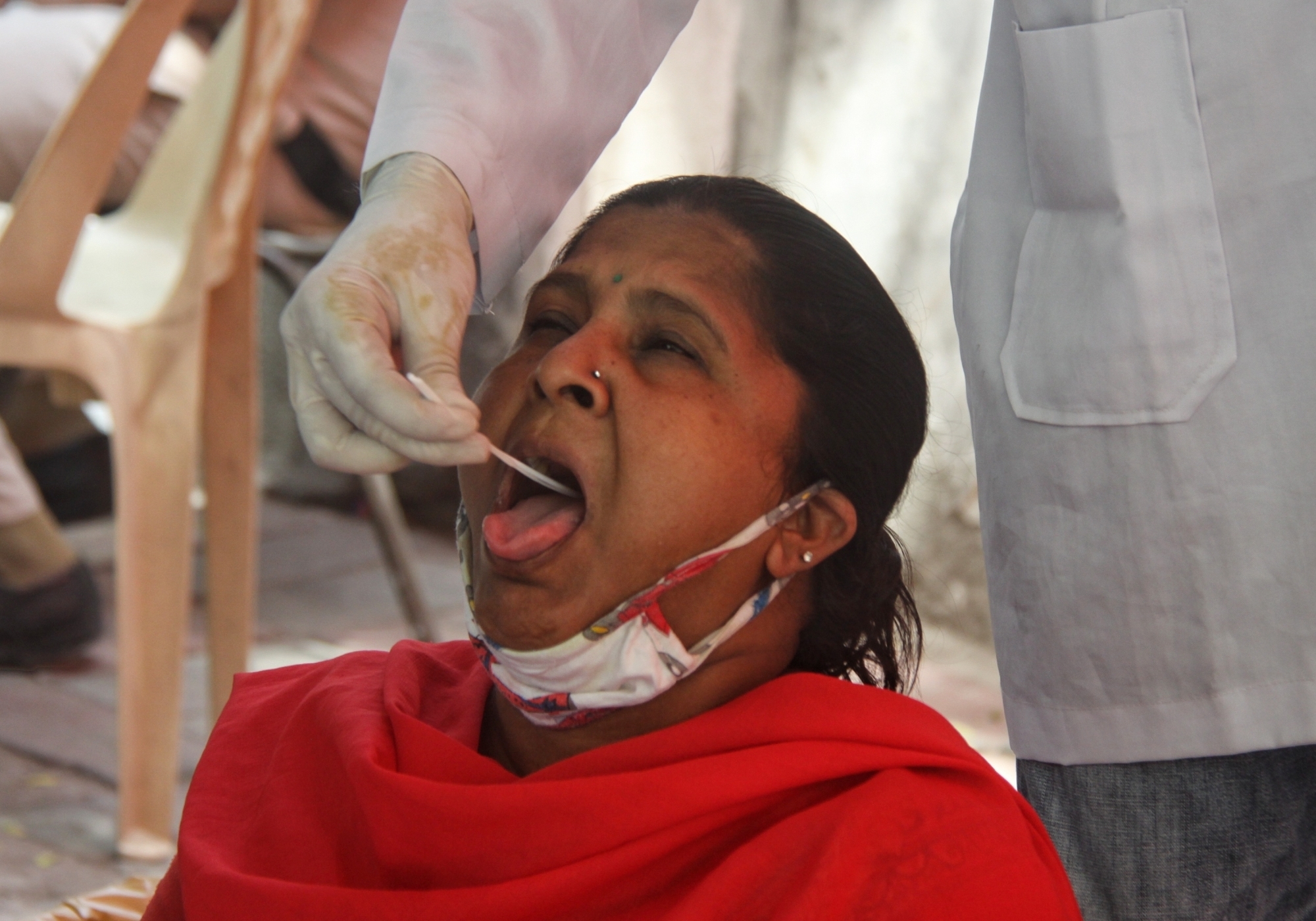 Active COVID-19 cases in country increase to 1,61,555