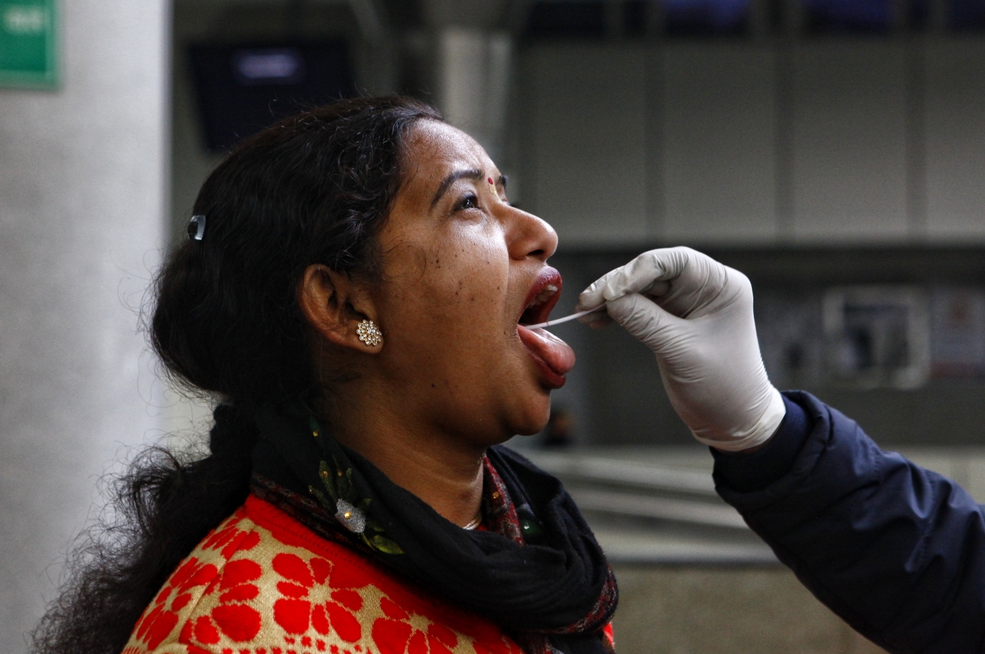 Lucknow reports 72 new Covid cases in 24 hrs