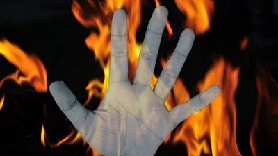 Minor pushed into fire, upper-caste students booked in Tamil Nadu