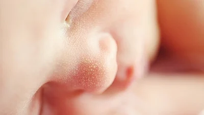 New smartphone app to detect jaundice in babies shows promise
