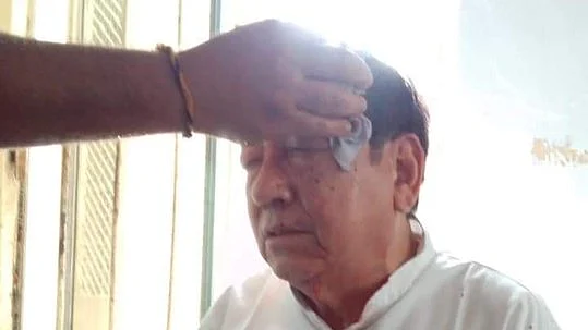 Tripura Congress president Birjit Sinha attacked inside Congress Bhavan in Agartala. A bleeding Sinha has been admitted to a pvt hospital
