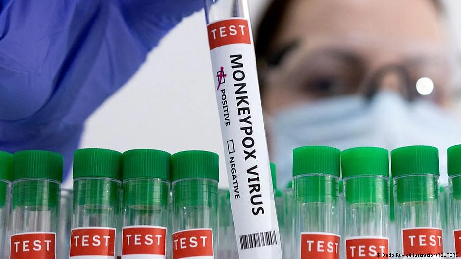 ICMR isolates monkeypox virus; invites companies to develop vaccines, diagnostic kits